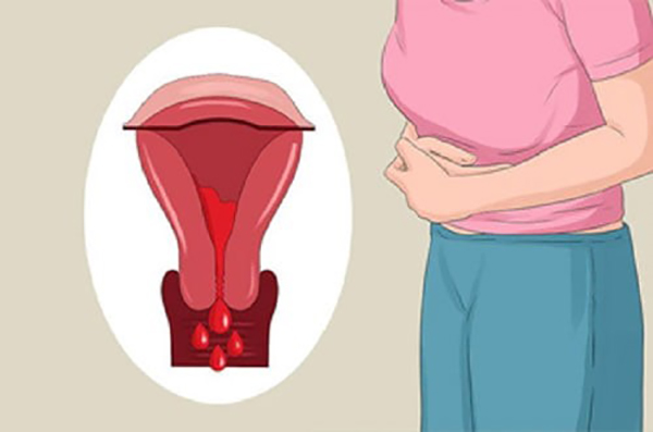 Bị rong kinh có thai được không?