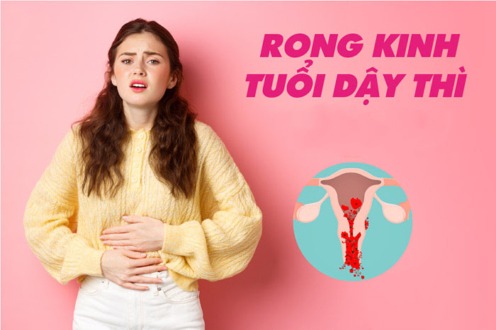 Rong kinh ở tuổi dậy thì và những vấn đề cần biết