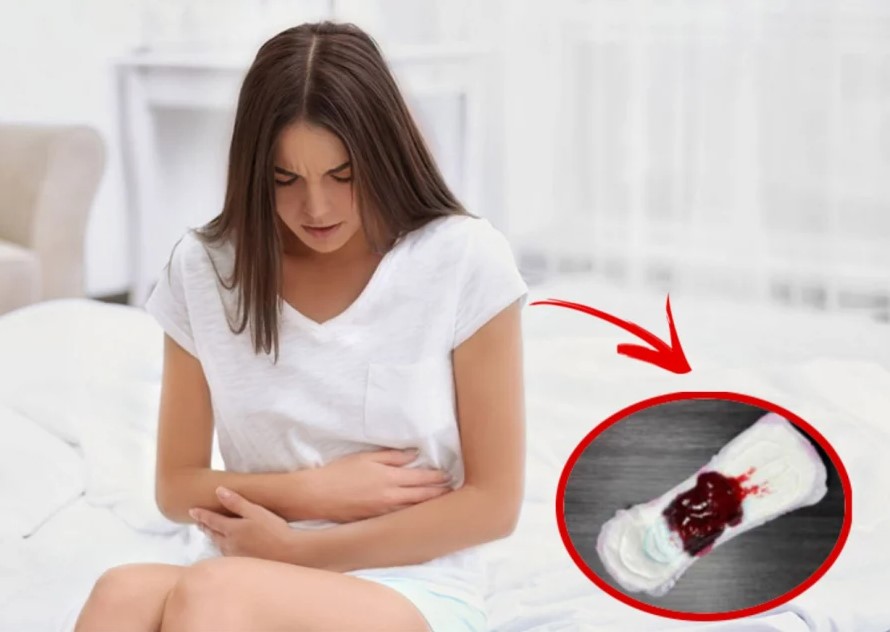 Kinh nguyệt ra nhiều máu cục: Dấu hiệu bất thường