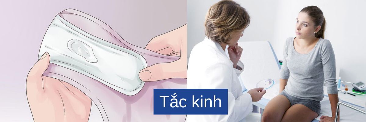 Làm thế nào để hỗ trợ cải thiện tắc kinh nguyệt tại nhà đơn giản?