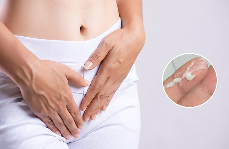 “Cảnh giác” kinh nguyệt không đều và ra nhiều huyết trắng