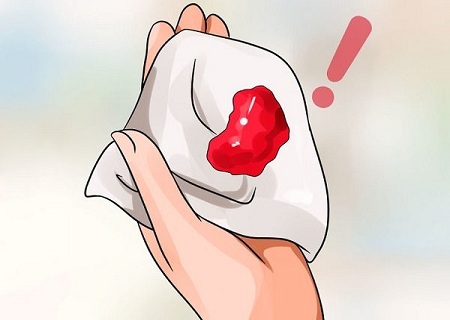 Đau rát và chảy máu sau khi quan hệ, chớ coi thường!