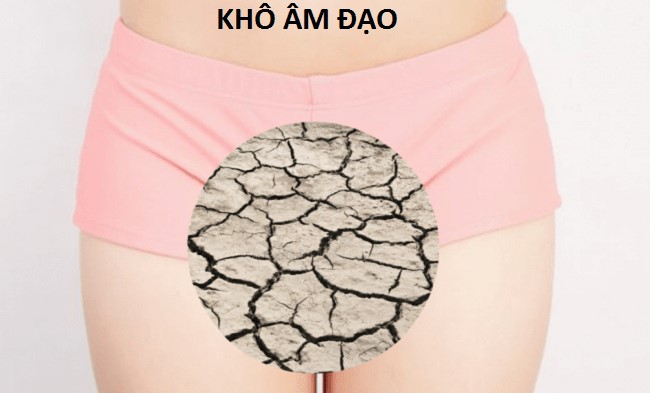 Khô âm đạo – sự “KHÔ HẠN” đáng sợ của phụ nữ