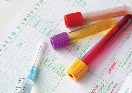 Thế nào là chỉ số nội tiết tố nữ bình thường?