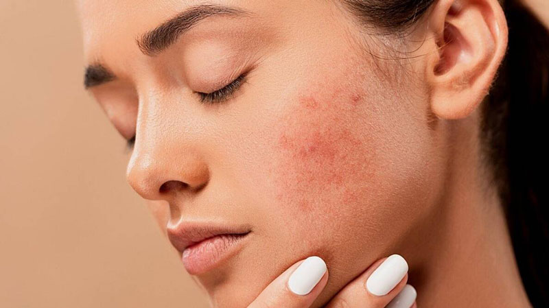 Da bị khô thường xuyên phải làm sao?