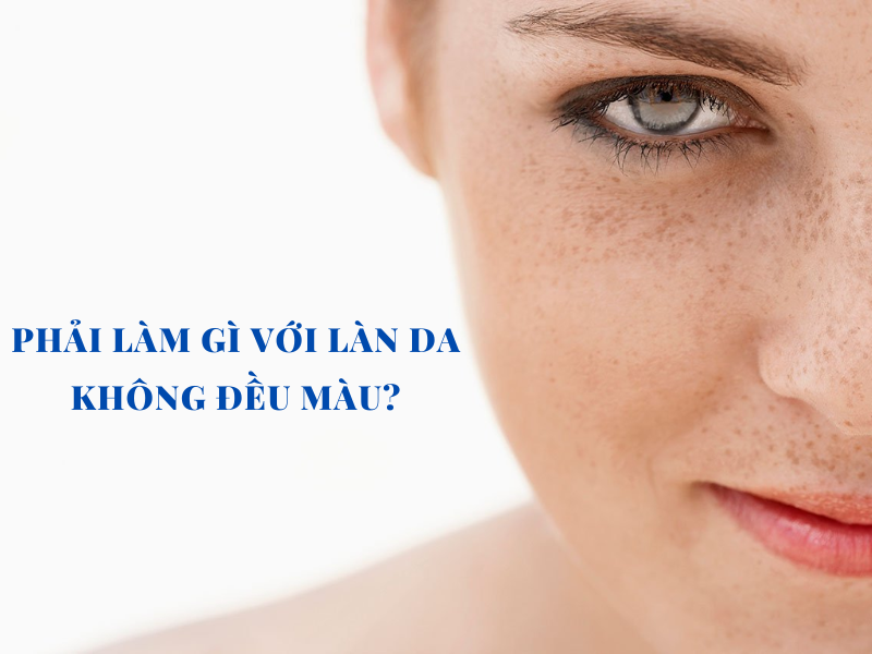 Khắc phục làn da không đều màu với 3 cách đơn giản