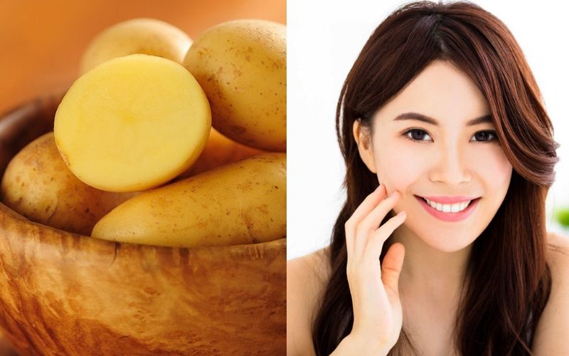 Cách trị vết thâm sau mụn bằng khoai tây đơn giản