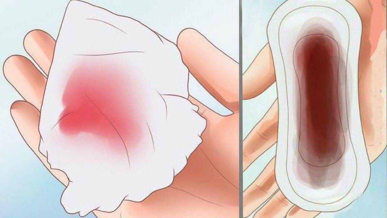 Màu sắc kinh nguyệt “tố cáo” tình trạng sức khỏe